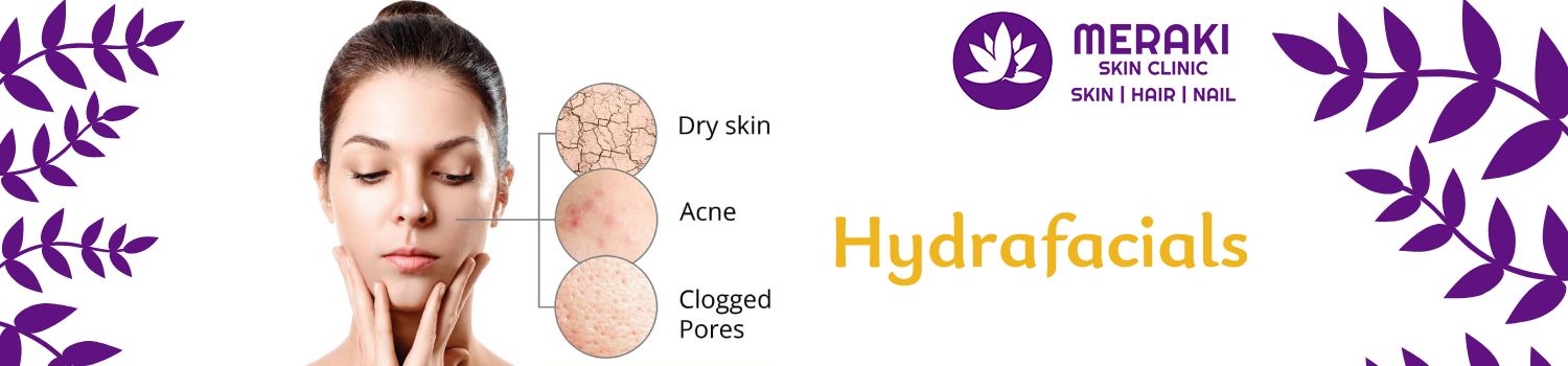 Hydrafacial: The Only Facial That Treats & Relaxes The Skin
