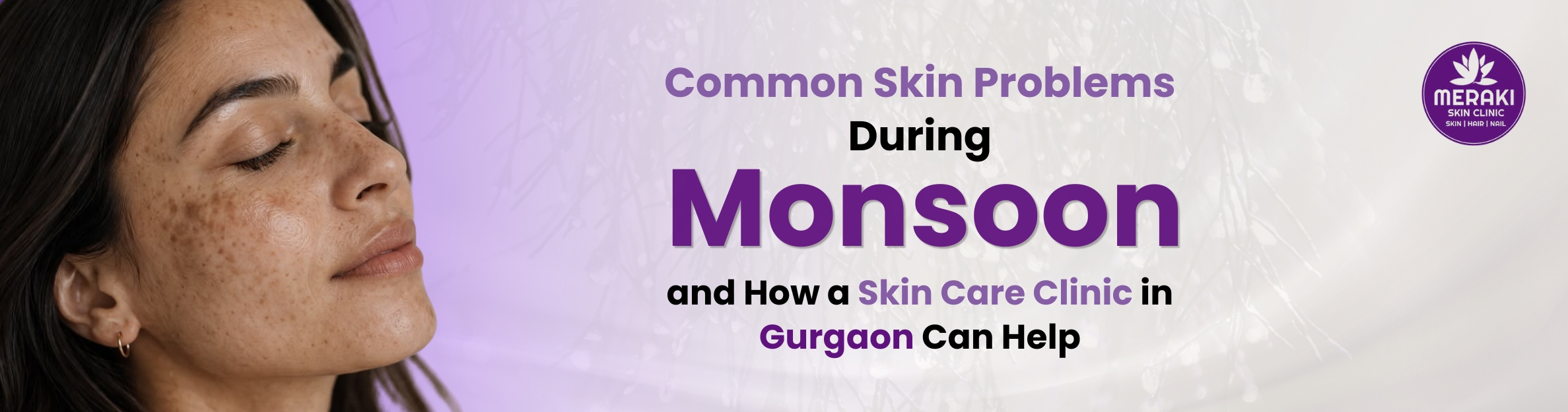 Common Monsoon Skin Problems – Skin Care Clinic Gurgaon