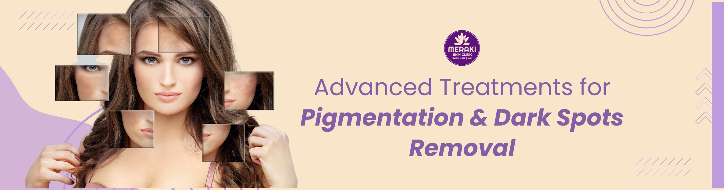Pigmentation & Dark Spots Removal – Best Skin Care Clinic Gurgaon