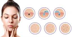 6 Skin Infections to Watch Out for During Monsoon