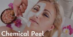 Chemical Peel