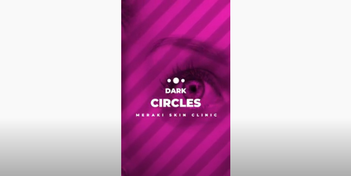 Dark Circles