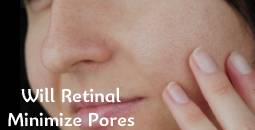 Will Retinal Minimize Pores