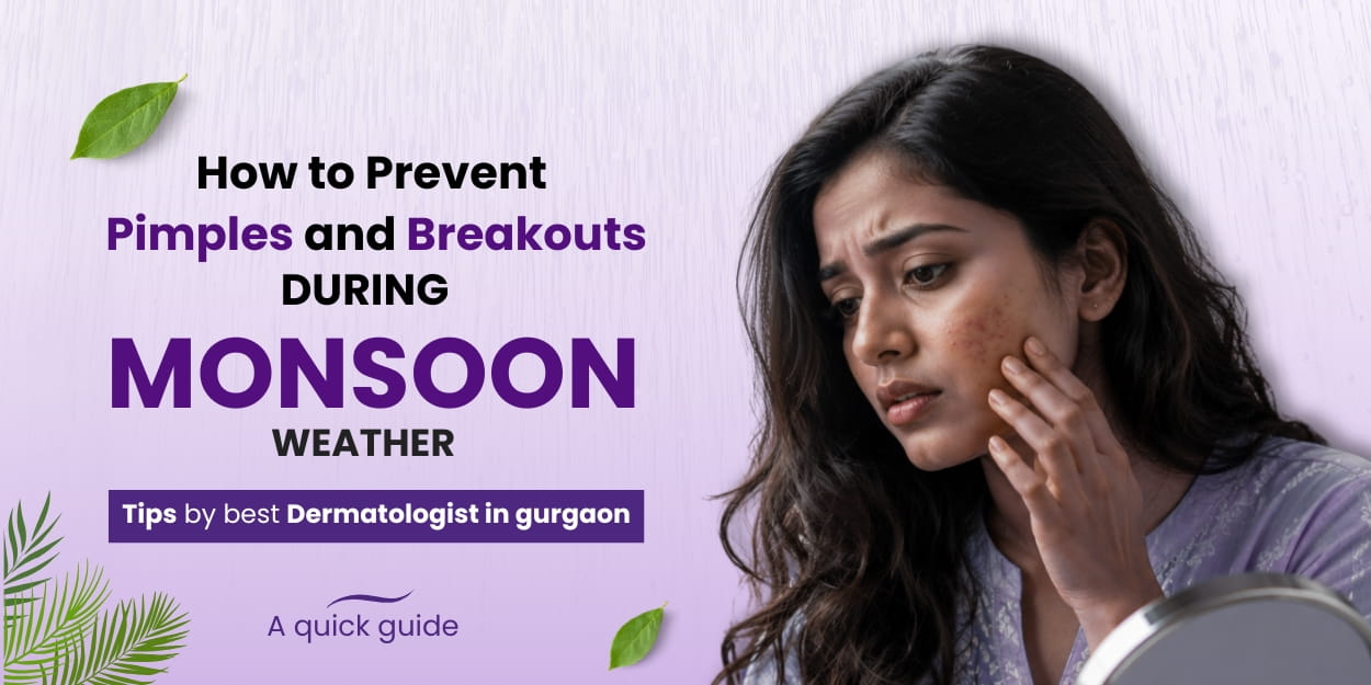 Prevent Pimples and Breakouts During Monsoon – Dermatologist Gurgaon
